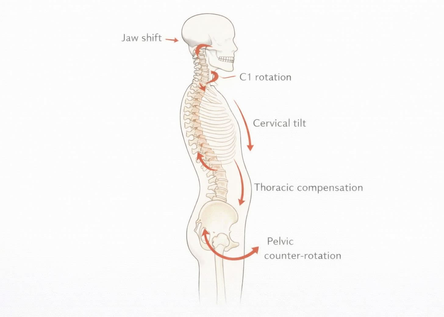 Skeletal posture misalignment diagram