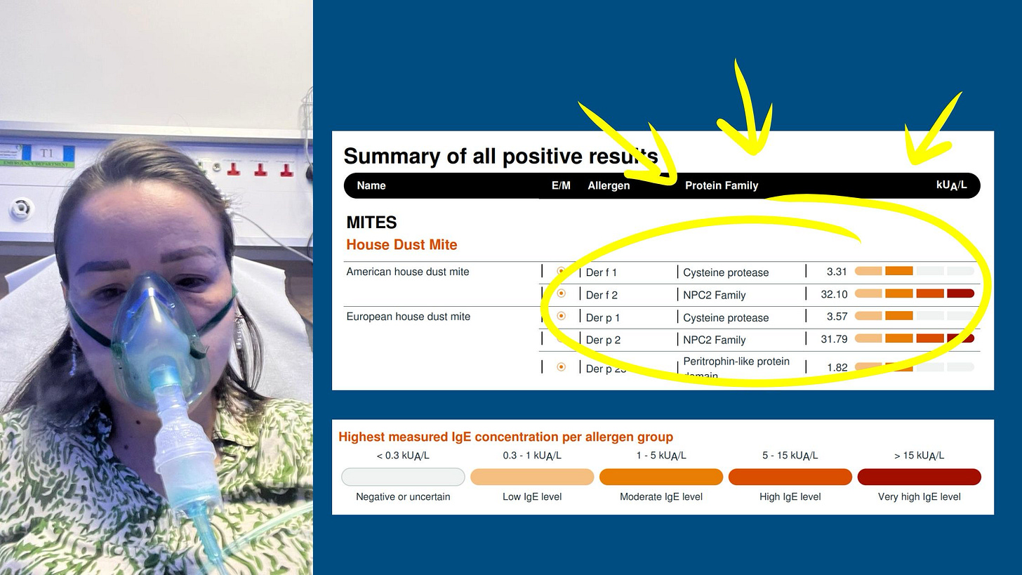 Summary of all positive
Name
MITES
House Dust Mite
American house dust mite
European house dust mite
E/M Allergen
I Derfl
I Derf2
I Der p 1
I Der p 2
I Der p
Protein Family
I Cysteine protease
I NPC2 Family
I Cysteine protease
I NPC2 Family
Peritrophin-like protein
kUA/L
3.31
32.10
3.57
31.79
1.82 Summary of all positive
Name
MITES
House Dust Mite
American house dust mite
European house dust mite
E/M Allergen
I Derfl
I Derf2
I Der p 1
I Der p 2
I Der p
Protein Family
I Cysteine protease
I NPC2 Family
I Cysteine protease
I NPC2 Family
Peritrophin-like protein
kUA/L
3.31
32.10
3.57
31.79
1.82