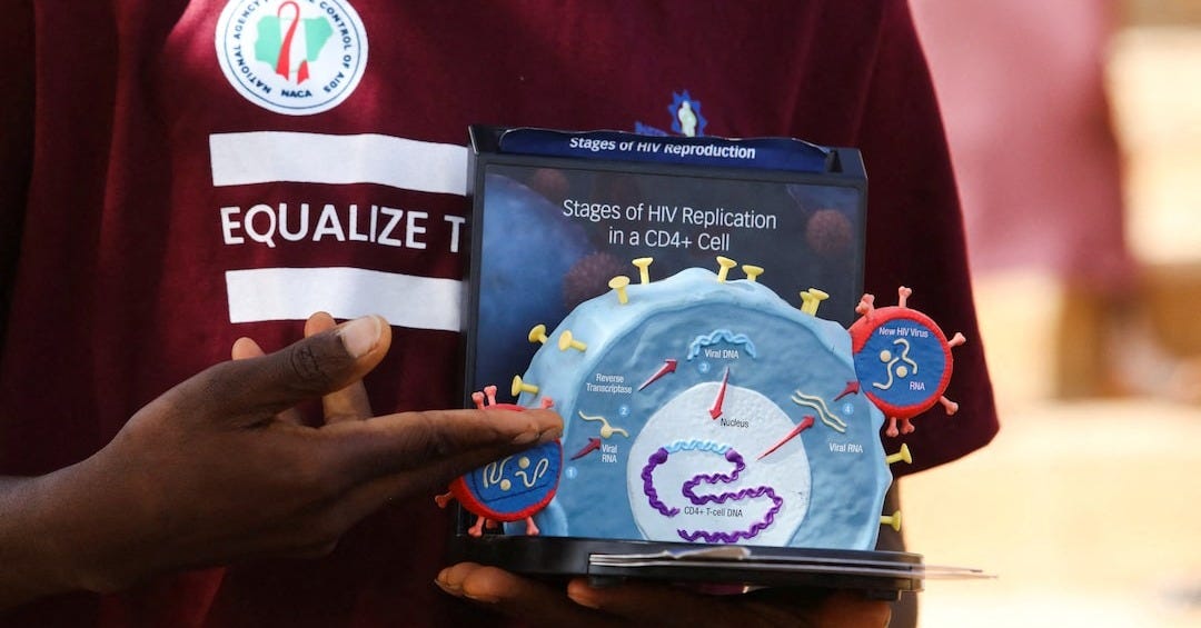 Small study shows one-time cell therapy can control HIV infection | Reuters