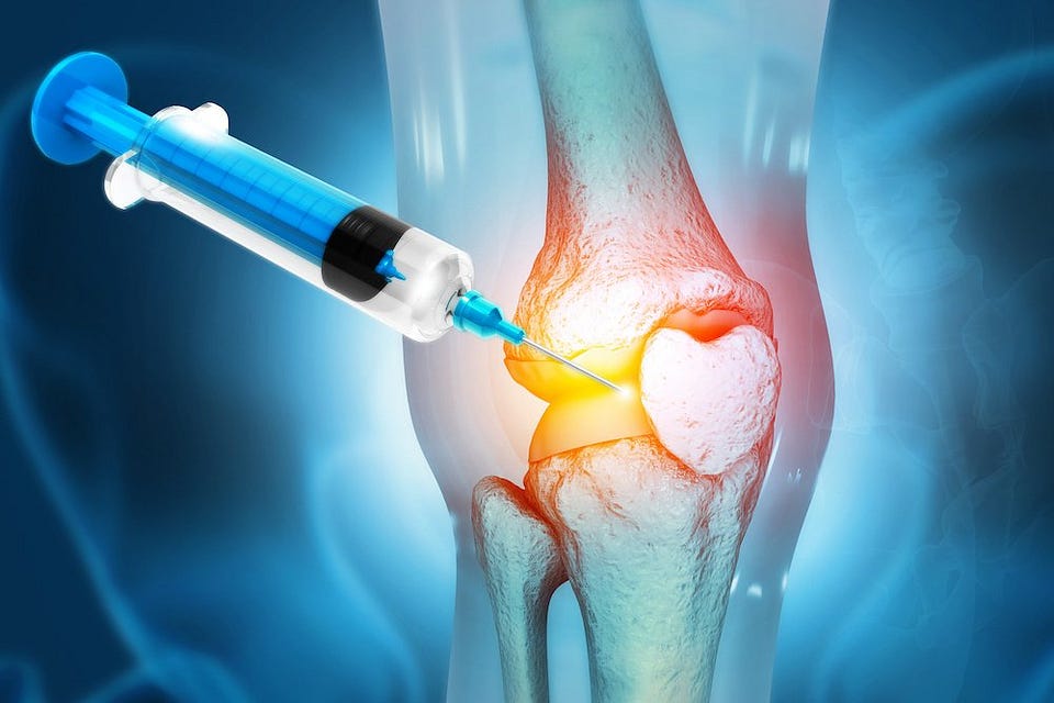 Joint Replacement and Arthritis Non-Surgical Options - Tidewater Physicians Multispecialty Group