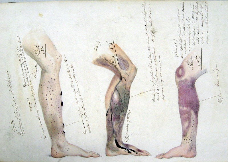 A close-up of a human body AI-generated content may be incorrect.