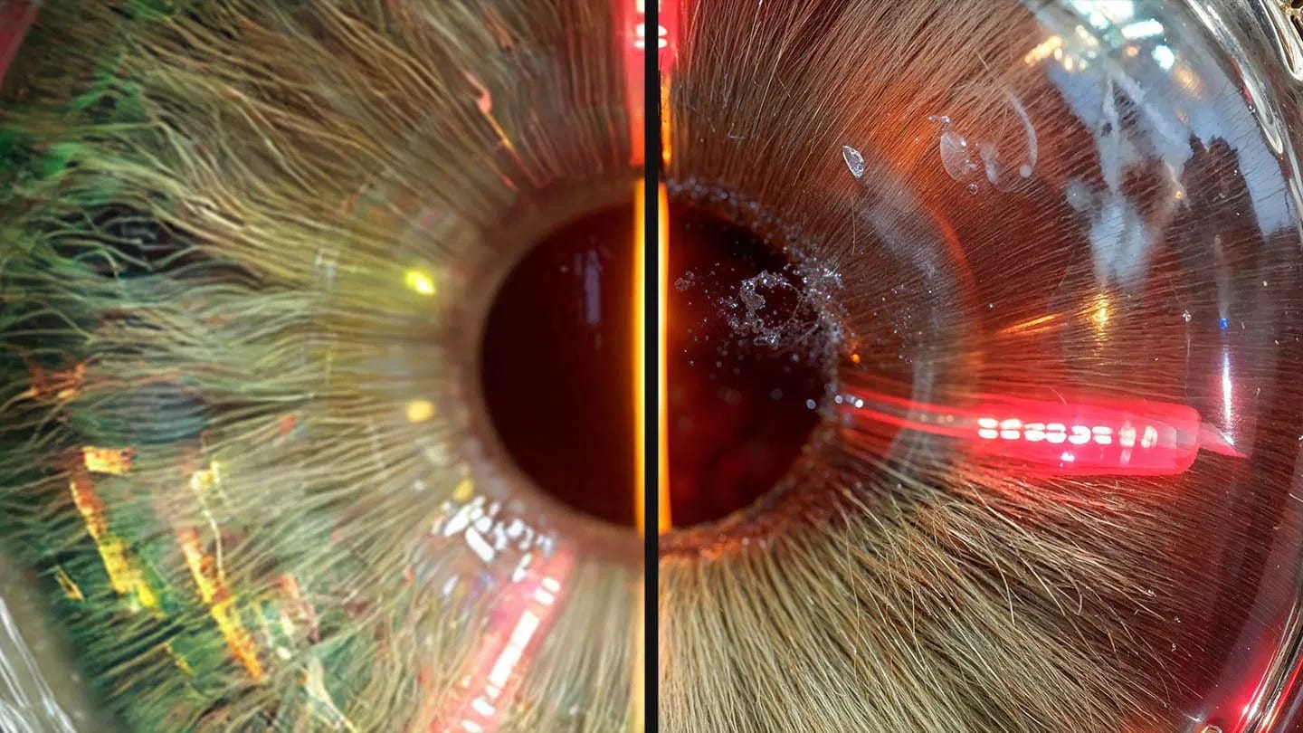 Close-up before-and-after comparison of an eye image showing enhanced detail and texture after creative AI upscaling.