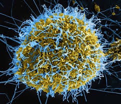 Ebola | Cause, Symptoms, Treatment ...