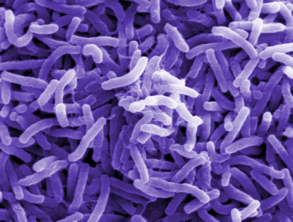 Cholera bacteria (Vibrio cholerae) | Scanning electron micro… | Flickr Cholera bacteria (Vibrio cholerae) | Scanning electron micro… | Flickr
