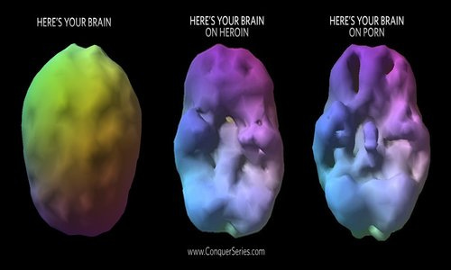 Porn use is addictive--brain scans and multiple scientific studies have proven it.