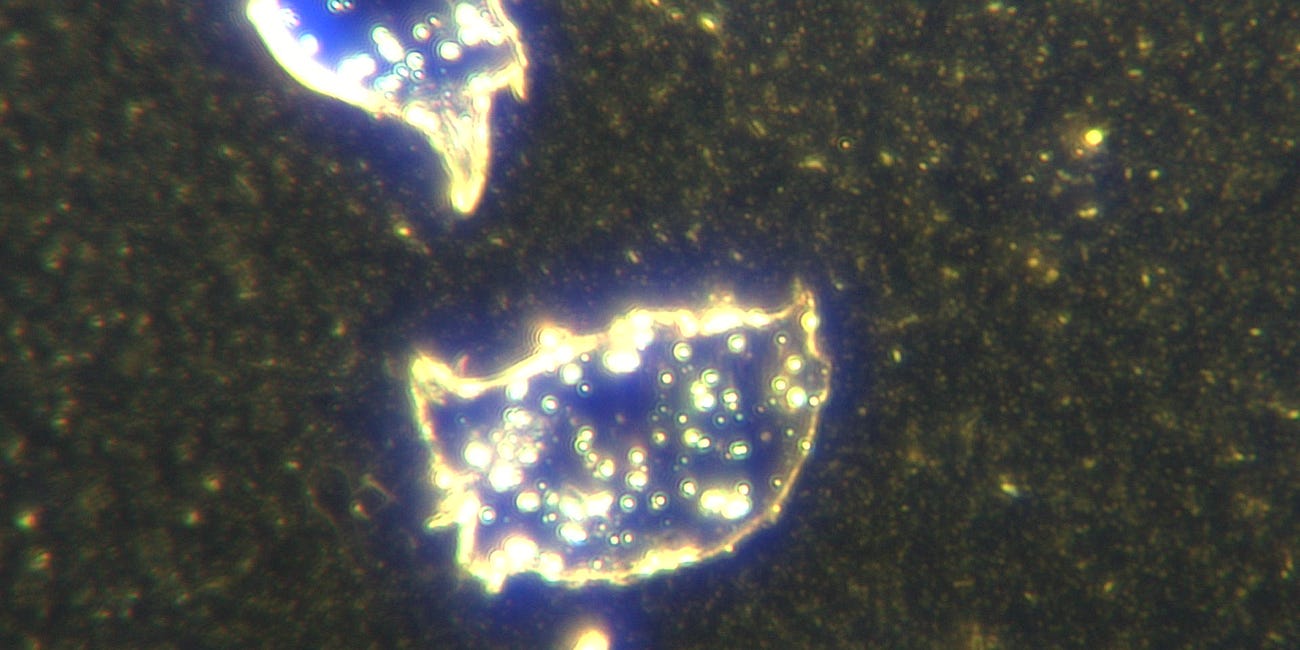 Pfizer BioNTech COVID19 Solution Builds Mesogen Microchips When Left At Room Temperature. Exactly What We See In COVID Unvaccinated Blood From Shedding. Two Week Follow Up