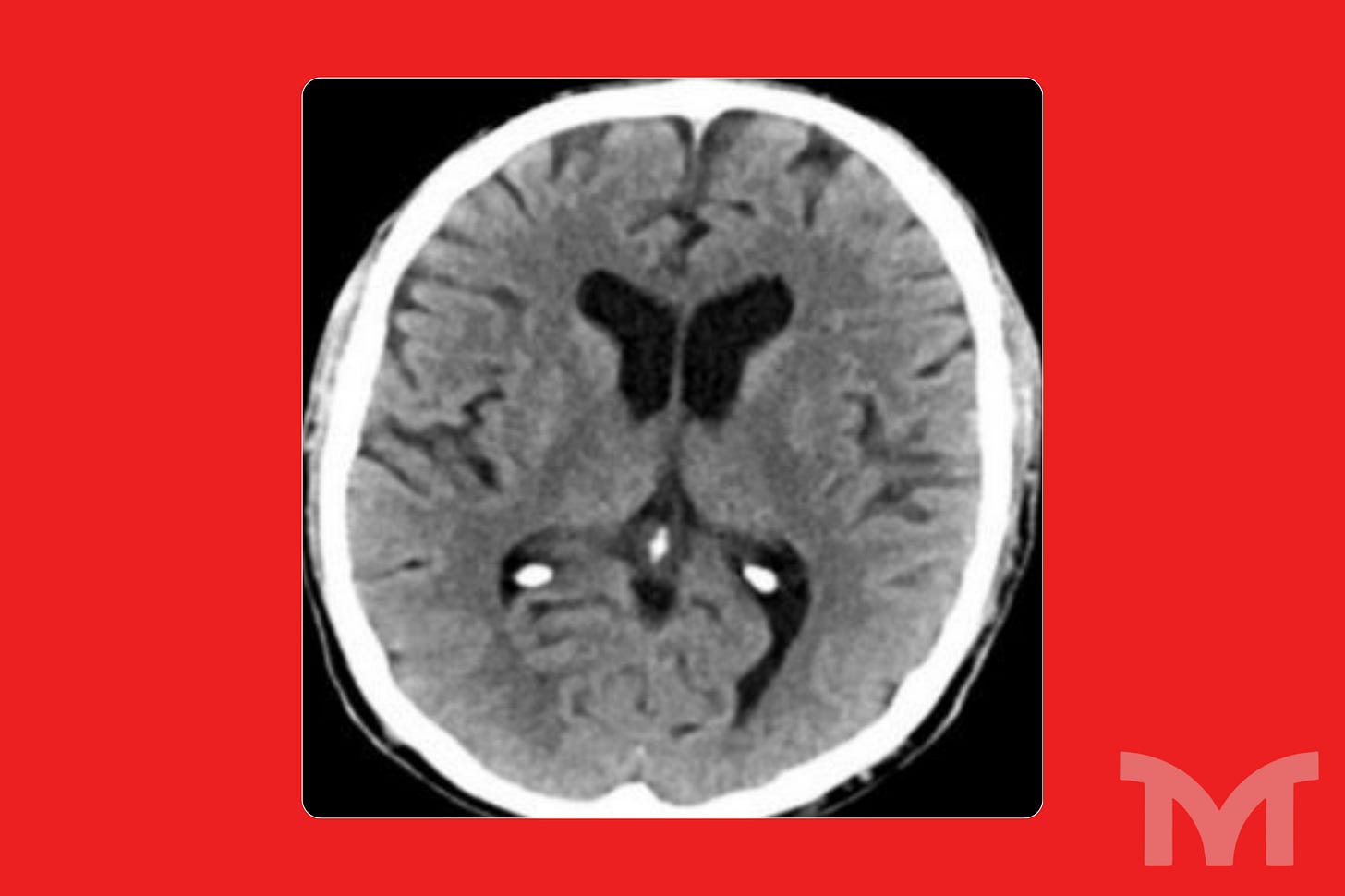 (Reprodução: EstratégiaMed)