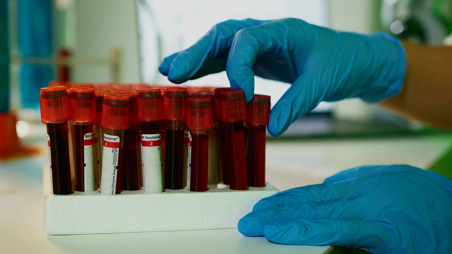 Photo by Artem Podrez on Pexels A lab technician handles blood vials in a laboratory setting, showcasing medical research. (stock photo)