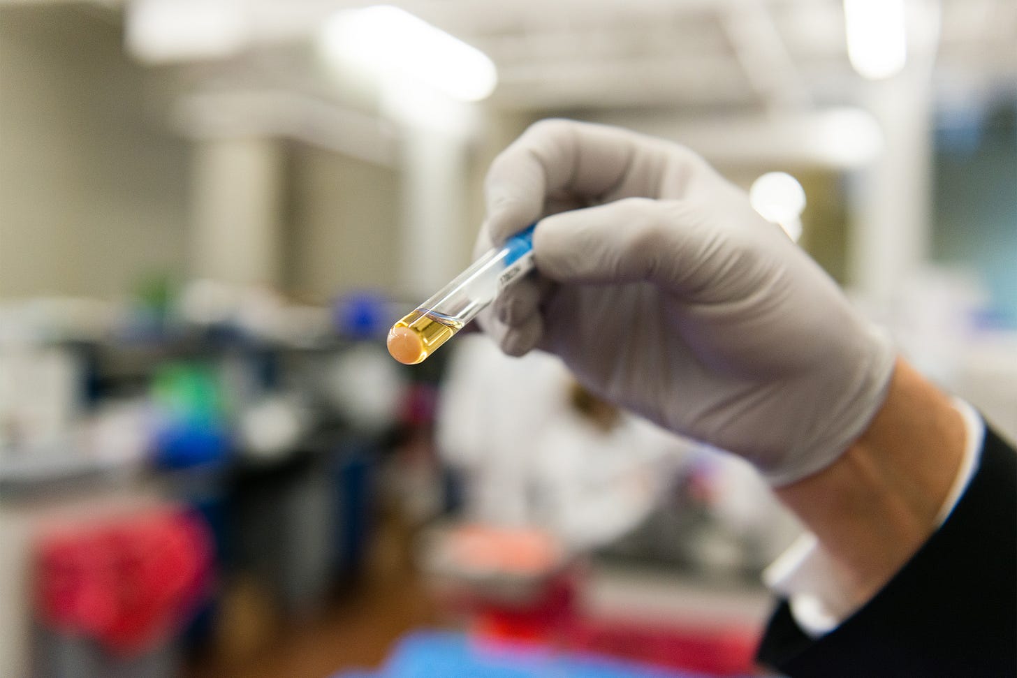 A photo of a vial of urine being held up by a gloved hand in a laboratory. A photo of a vial of urine being held up by a gloved hand in a laboratory.