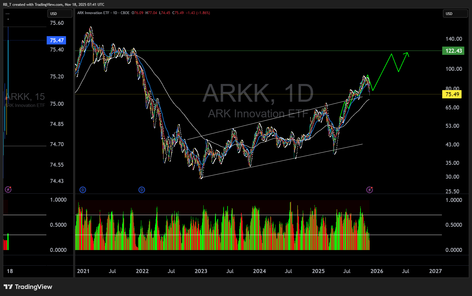 The ARKK Buy Opportunity: Why $75 Sets Up The Next $122 Move