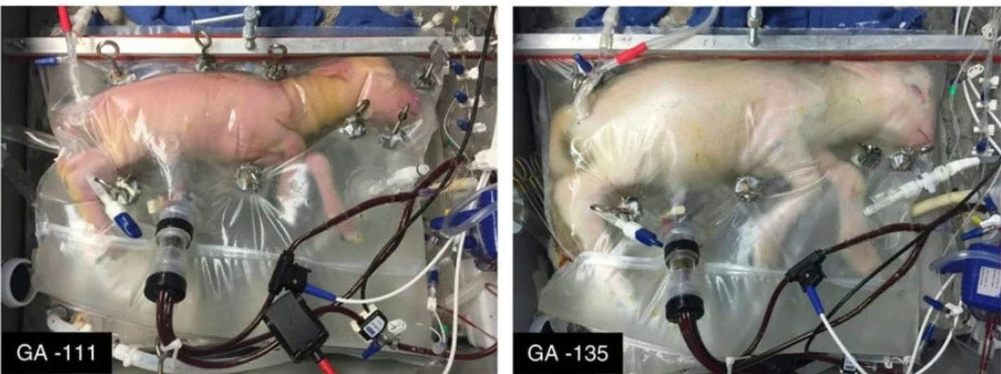 Researchers Have Successfully Grown Premature Lambs in an Artificial Womb Researchers Have Successfully Grown Premature Lambs in an Artificial Womb