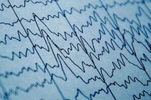 Brain wave printout