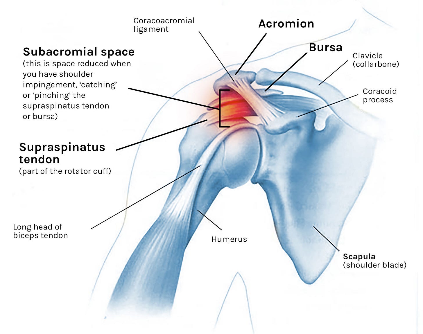 Diagram Of Shoulder Impingement