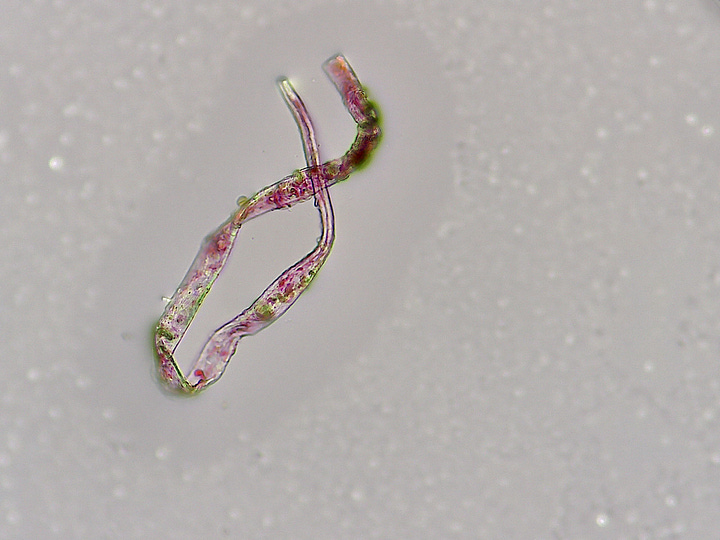 More 'Things' in urine samples