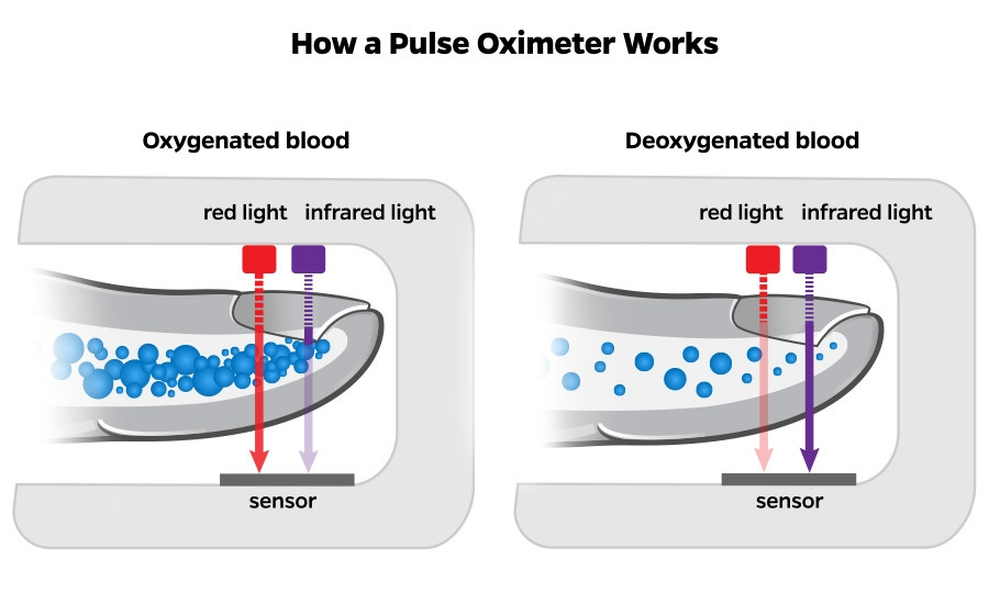Pulse Oximeters' Racial Bias | Johns Hopkins | Bloomberg School of Public  Health