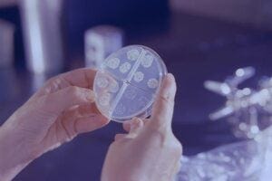 Discovery of biomarkers found in highly-infectious patients raises hopes of new TB test