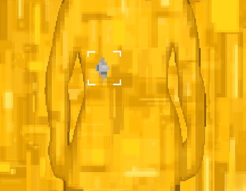 Illustartion of a human body with a target mark around a potential tumour
