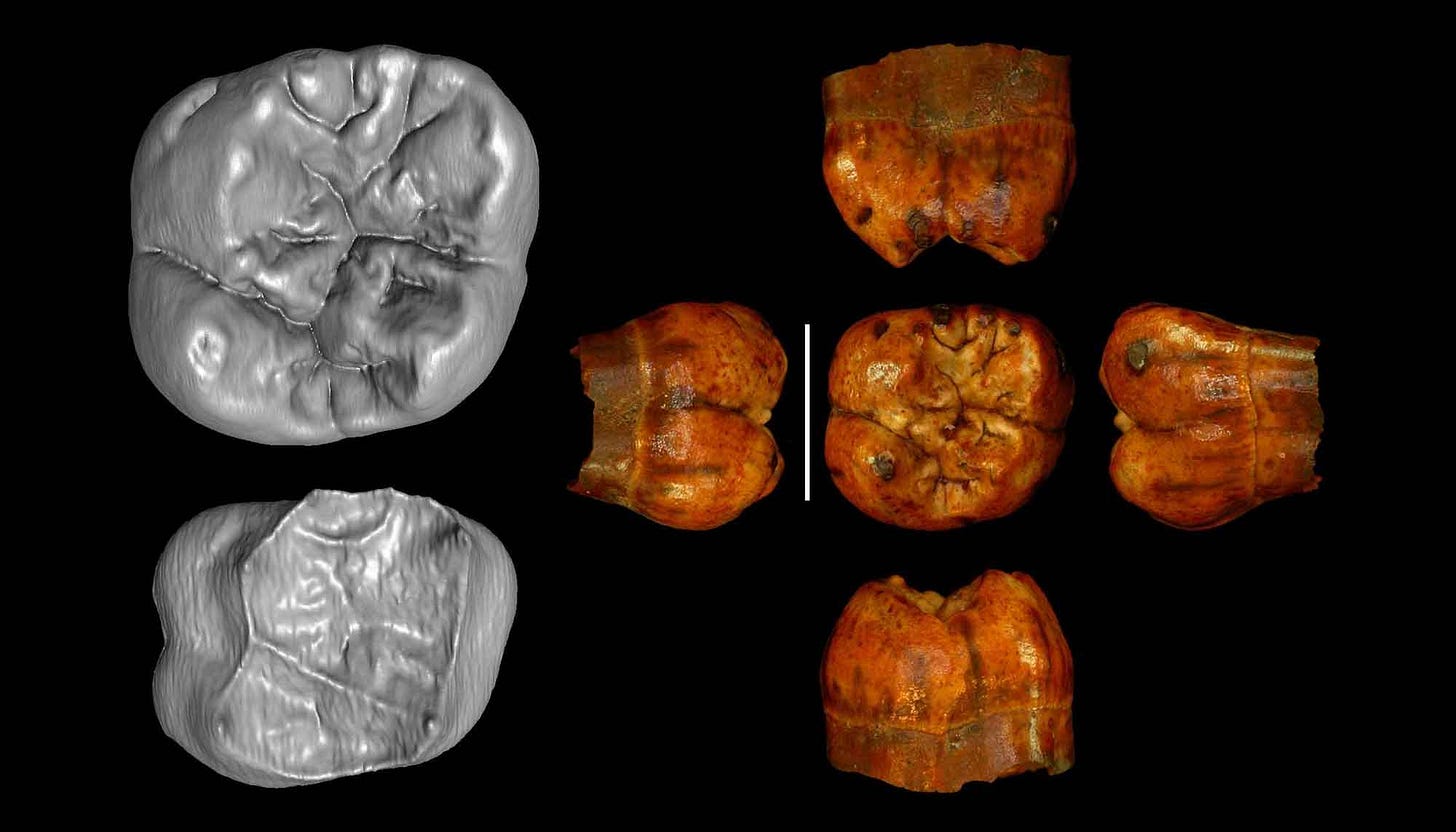Images of the #Ish25 tooth, described in caption Images of the #Ish25 tooth, described in caption
