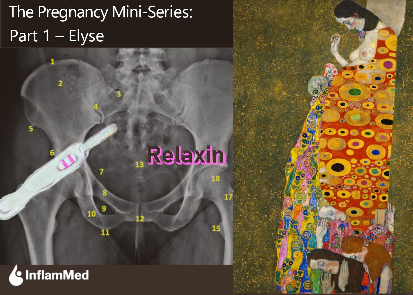 Left side: A pregnancy test stick with two pink lines showing it is positive; the word Relaxin is outlined in pink; the background is a female's frontal pelvic X-Ray radiograph. Right side: Klimt's Hope, II. Left side: A pregnancy test stick with two pink lines showing it is positive; the word Relaxin is outlined in pink; the background is a female's frontal pelvic X-Ray radiograph. Right side: Klimt's Hope, II.