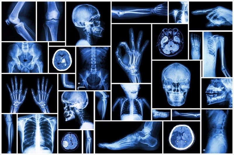 X-rays – How they work and what they show
