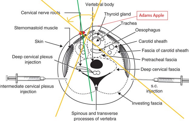A diagram of a human body

AI-generated content may be incorrect.