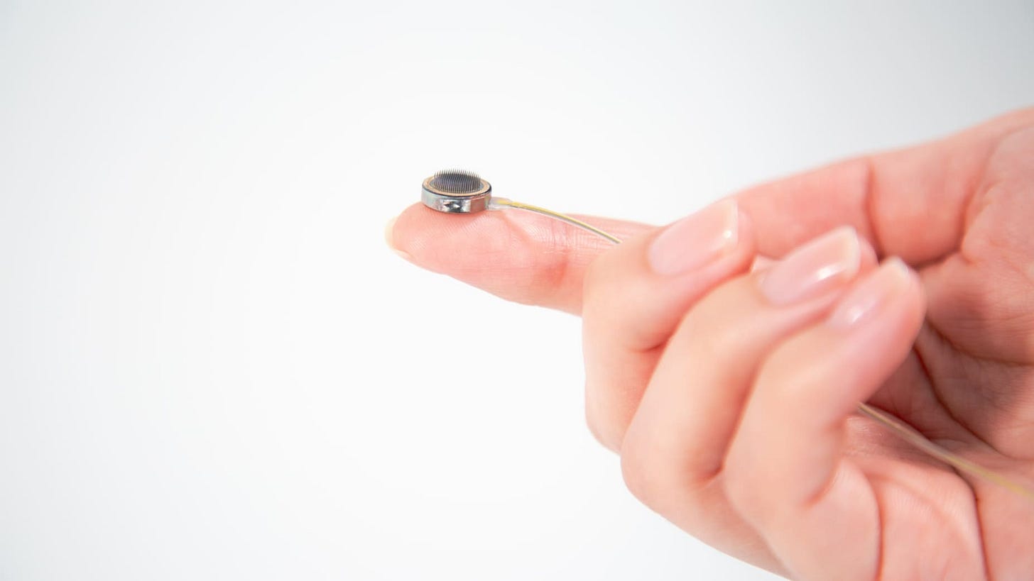 Paradromics' Connexus Brain-Computer Interface.