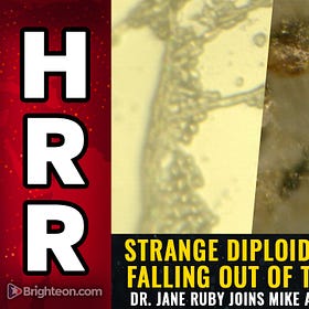 Poisonous FOG: Microscopic Analysis Suggests Unknown BIOLOGICAL CONTAMINANTS Falling From the Sky