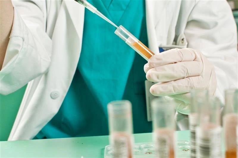 Urine test could reveal prostate cancer | Karolinska Institutet