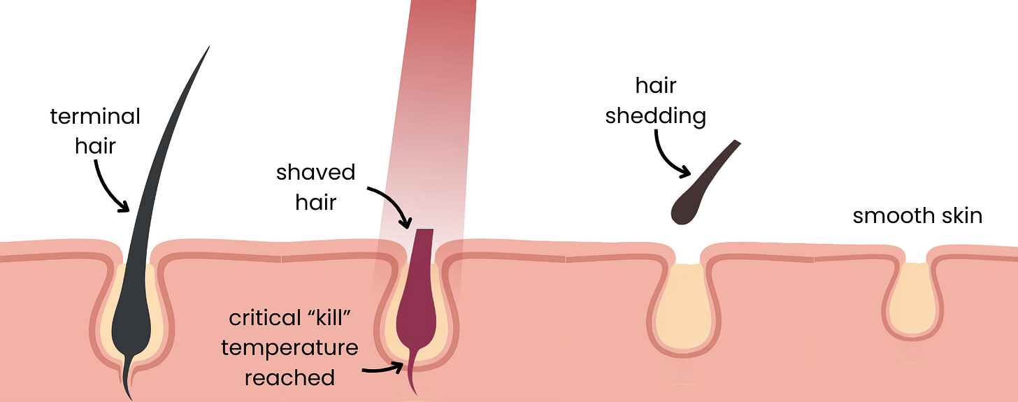 The Science of Selective Photothermolysis