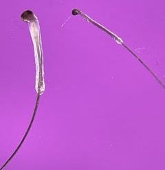 Close-up under dermoscopy of a hair removed from the follicle in the skin. You can see the root sheath and hair bulb, and the hair shaft extends out of the frame of the image.