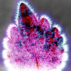 Kirlian photography - Wikipedia