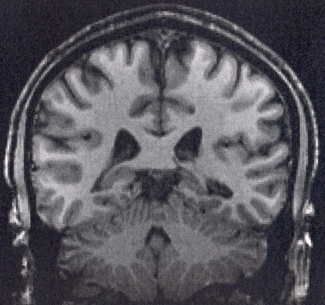 Your Brain Has a Door