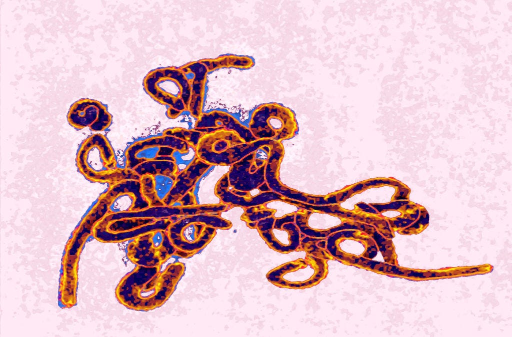 CDC holds unusual Ebola briefing, won't confirm U.S. exposures