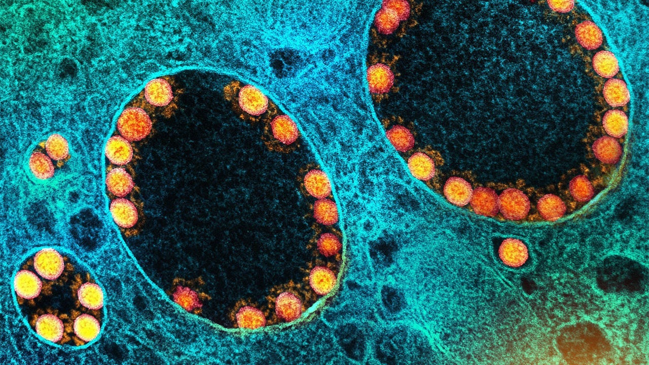 Olfactory Axon Injuries, Microvascular Pathology Seen in COVID-19 | MedPage  Today