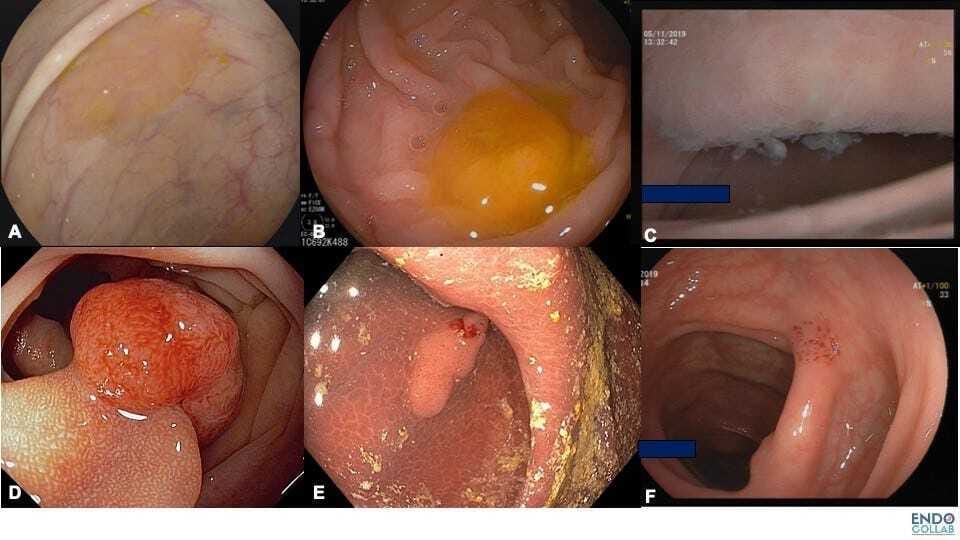 A collage of images of a person's body Description automatically generated