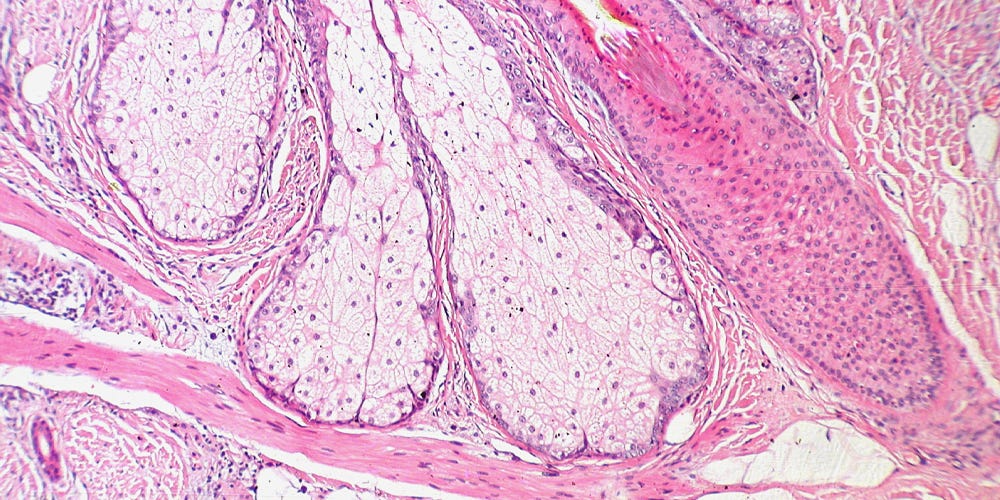 Keeping skin healthy: New method provides molecular portrait of sebum production Keeping skin healthy: New method provides molecular portrait of sebum production