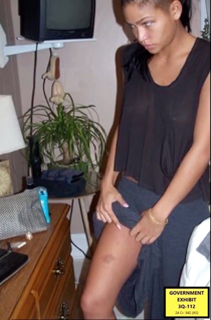 pic of cassie's injuries pic of cassie's injuries