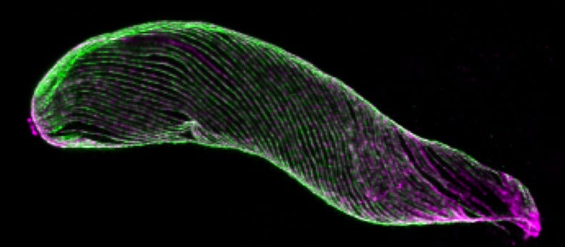 Secrets of Malaria parasite skeleton exposed - 2021 - Wiley Analytical  Science