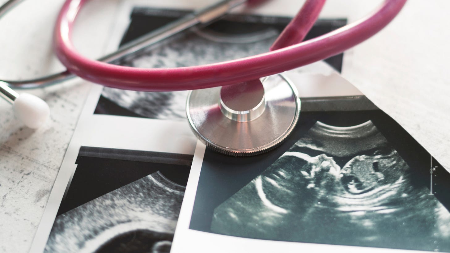 Close-up of printed ultrasound images with a pink stethoscope resting on top, symbolizing modern surrogacy and prenatal care