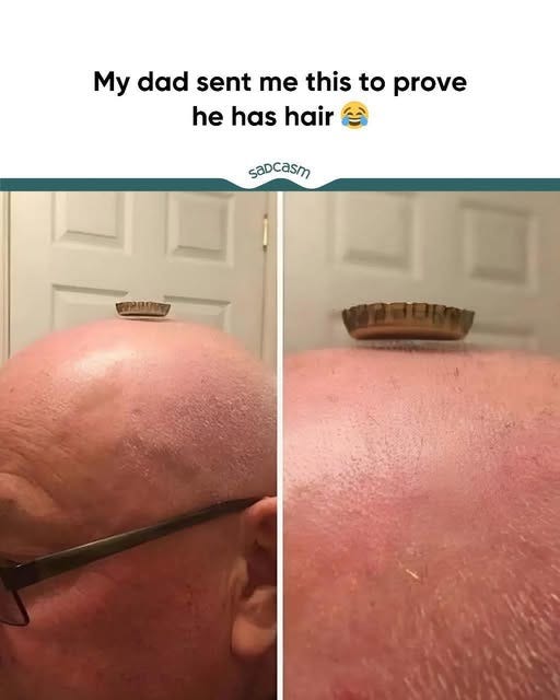May be an image of text that says 'My dad sent me this to prove he ne has hair saDcasm'