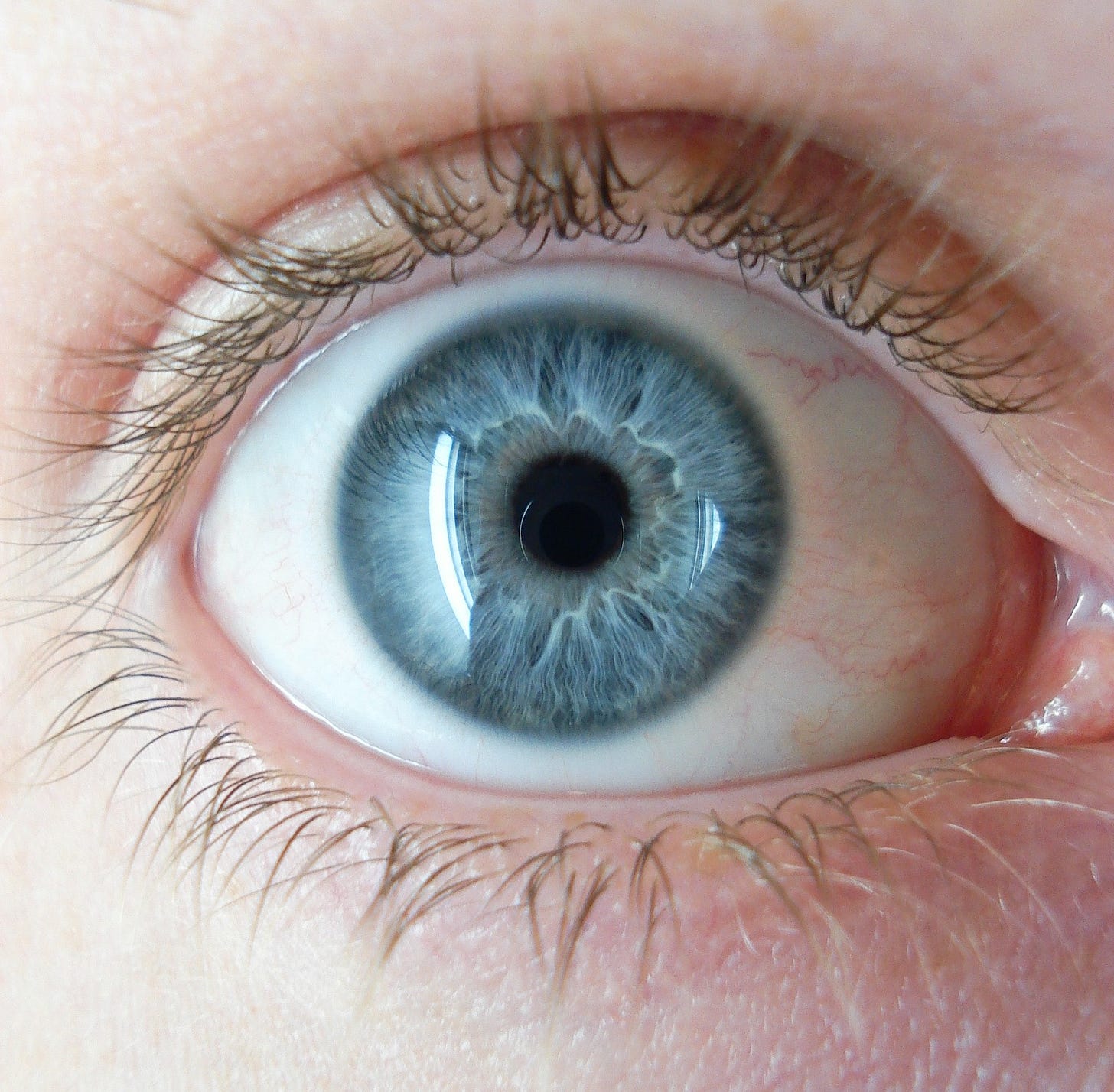 Iris (anatomy) - Wikipedia