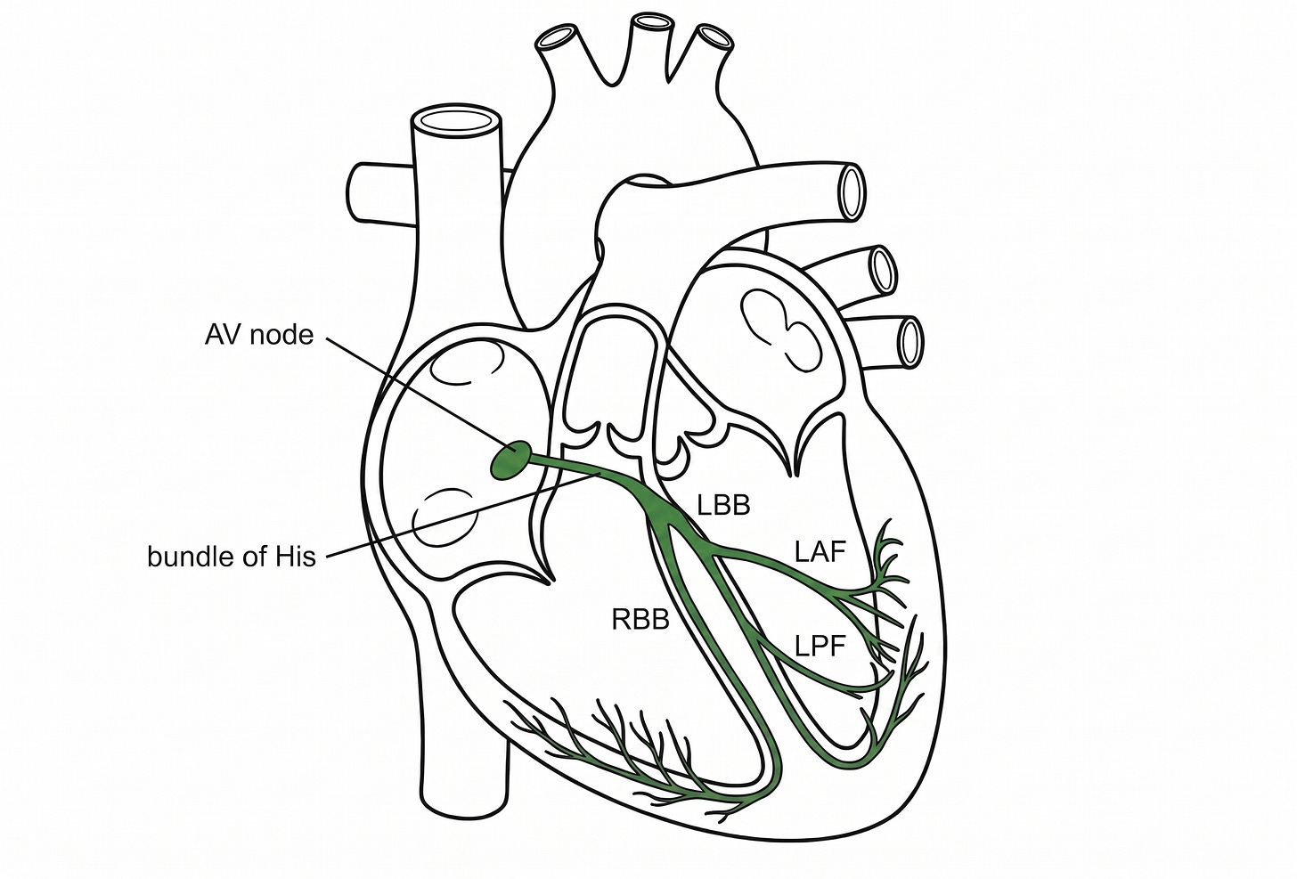 Cardiac conduction system anatomy below the AV node: AV node, bundle of His, right bundle branch, left bundle branch dividing into left anterior and posterior fascicles