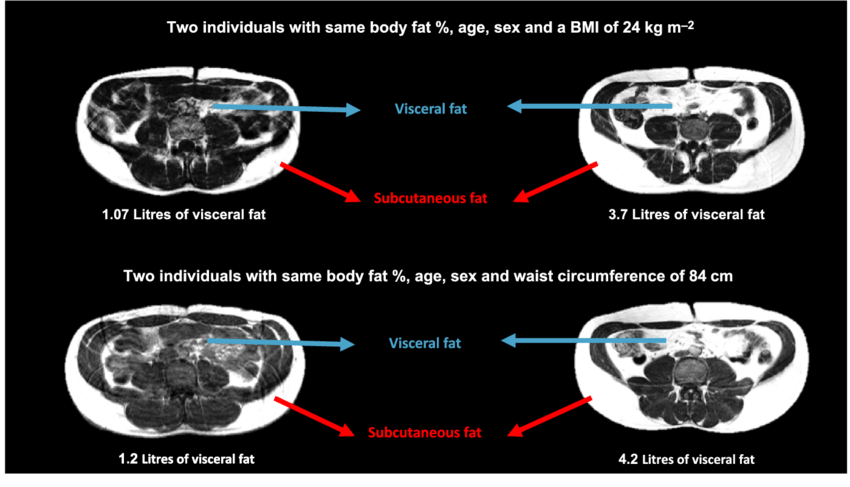 Transverse slices of 4 participants from abdominal MRI measures.... | Download Scientific Diagram