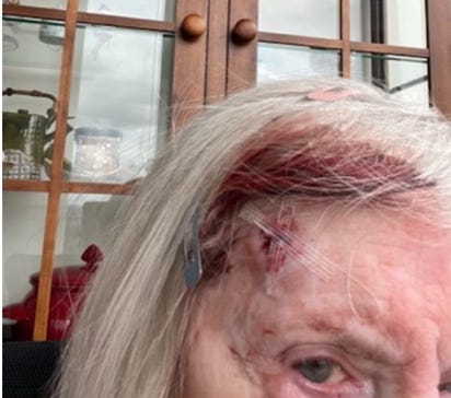 ICE & CBP Get Away With It – But Should They? - The Supremacy Clause & Qualified Immunity