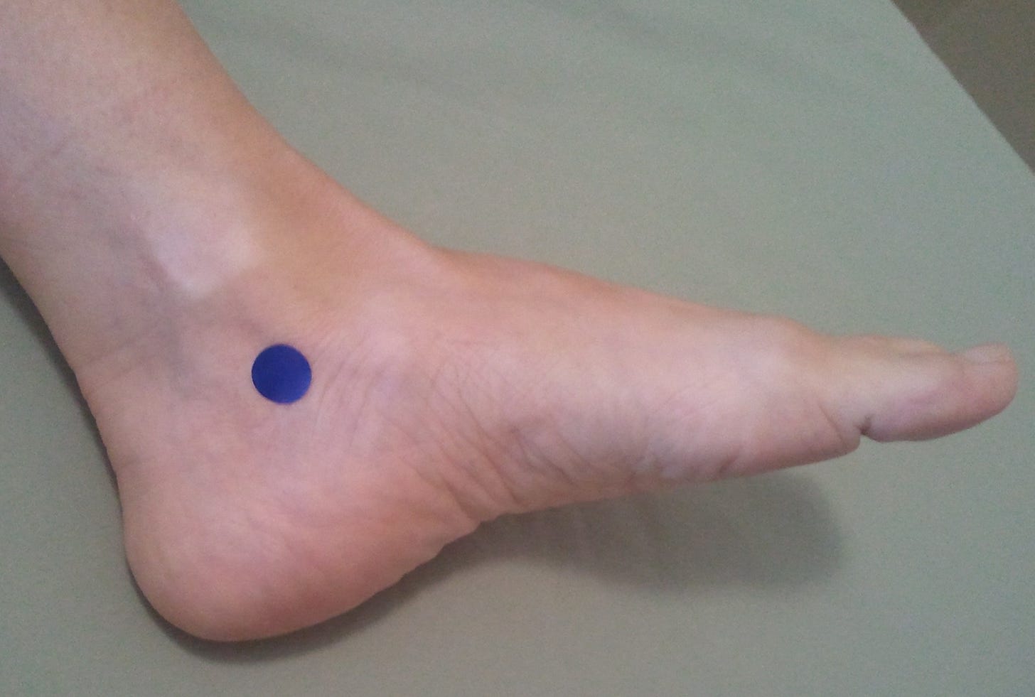 Two Extraordinary Points | Five Element Acupressure