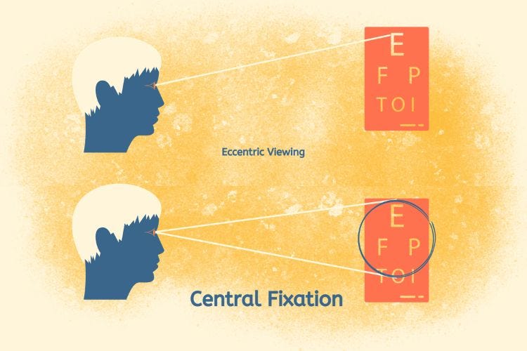 Central Fixation via Full Eyes Open Central Fixation via Full Eyes Open
