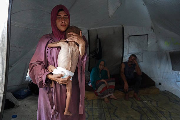 Palestinian woman holds her severely malnourished 1.5-year-old son, Muhammad Zakariya Ayyoub al-Matouq, inside a tent shelter in Deirl Al-Balah, Gaza...