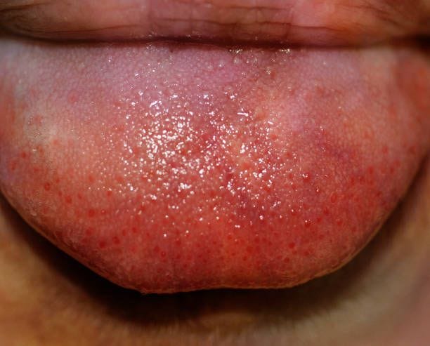 tongue lashing by nathan griffith - ugly art stock pictures, royalty-free photos & images