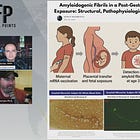 BREAKING: Prion-Like Amyloid Fibrils Found in 3-Year-Old Born Lifeless After In-Utero Pfizer mRNA Injection Exposure