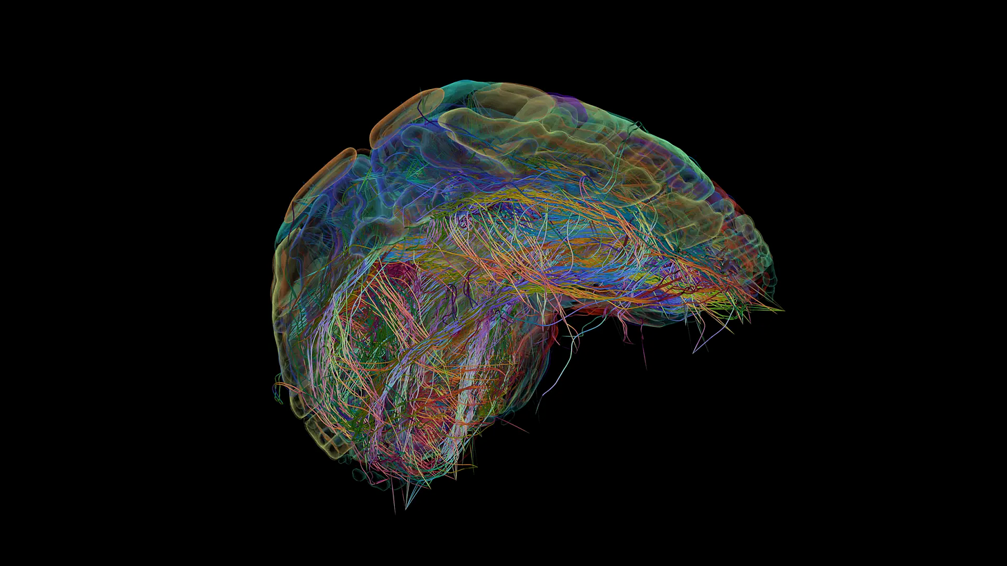 Neocortex_083.webp Neocortex_083.webp